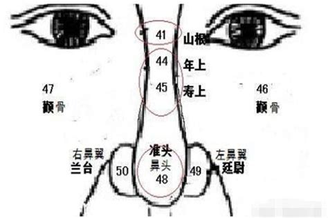 鼻头痣|鼻尖痣（六十四颗金钱痣）作者程相